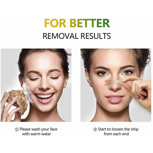 Factory spot wholesale ventilation nasal patch to relieve nasal congestion physical expansion nasal passage to improve nasal ventilation patch